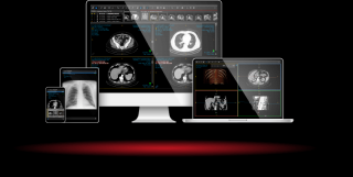crystal reports specialists montreal Intelerad Medical Systems